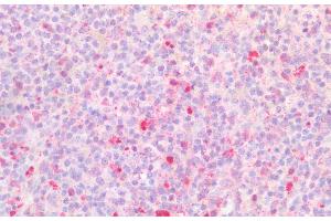 Detection of BST1 in Human Spleen Tissue using Polyclonal Antibody to Bone Marrow Stromal Cell Antigen 1 (BST1) (BST1 antibody  (AA 63-313))