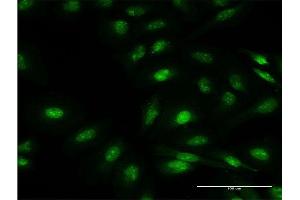 Immunofluorescence of monoclonal antibody to FBXO7 on HeLa cell. (FBXO7 antibody  (AA 357-455))