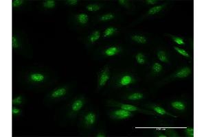 Immunofluorescence of monoclonal antibody to FBXO7 on HeLa cell. (FBXO7 antibody  (AA 357-455))