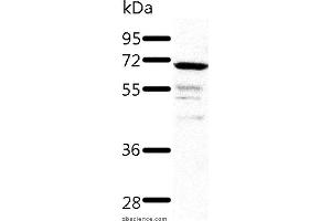 Western blot analysis of Human fetal kidney tissue, using TRAF3 Polyclonal Antibody at dilution of 1:500 (TRAF3 antibody)