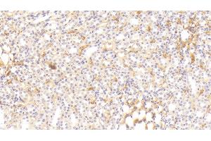 Immunohistochemistry (IHC) image for anti-Inter alpha Globulin Inhibitor H4 (ITIH4) (AA 478-722) antibody (ABIN7439225)