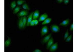 Immunofluorescence staining of A549 cells with ABIN7157473 at 1:166, counter-stained with DAPI. (CRYM antibody  (AA 169-258))