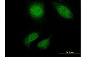 Immunofluorescence of monoclonal antibody to TTN on HeLa cell. (Titin antibody  (AA 1-110))