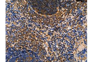 ABIN6262672 and ABIN6276585 at 1/100 staining Rat spleen tissue by IHC-P. (ISG15 antibody  (C-Term))