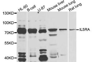 Western blot analysis of extracts of various cells, using IL5RA antibody. (IL5RA antibody)