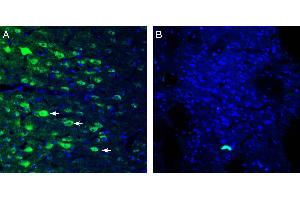 Expression of GPR109A in rat cingulate cortex. (Hydroxycarboxylic Acid Receptor 2 (HCAR2) Peptide)
