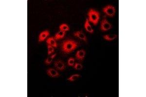 Immunofluorescent analysis of VAP-B/C staining in Hela cells. (VAPB antibody)