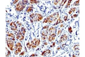 IHC testing of FFPE human uterus with recombinant Caldesmon antibody (clone CALD1/1424R). (Recombinant Caldesmon HMW antibody)