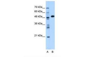 Image no. 1 for anti-Alanine Aminotransferase (ALT) (AA 115-164) antibody (ABIN320980)