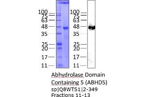 Western Blotting (WB) image for Abhydrolase Domain Containing 5 (ABHD5) (AA 2-349) protein (His tag) (ABIN3104368) (ABHD5 Protein (AA 2-349) (His tag))