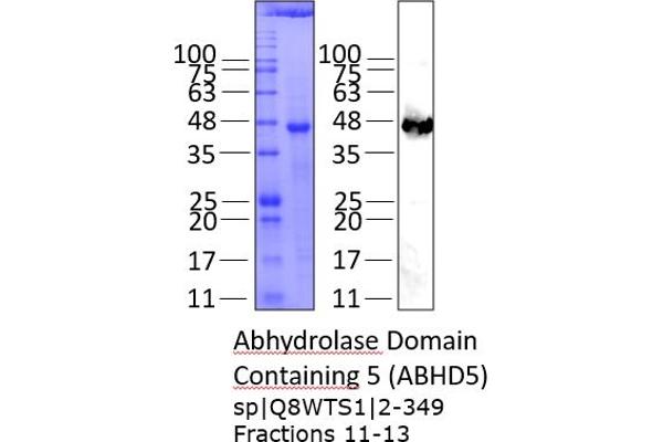ABHD5 Protein (AA 2-349) (His tag)