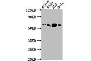 Western Blot Positive WB detected in: MCF-7 whole cell lysate, A549 whole cell lysate, 293 whole cell lysate, Hela whole cell lysate All lanes: PDE1B antibody at 1:1000 Secondary Goat polyclonal to rabbit IgG at 1/50000 dilution Predicted band size: 62, 60 kDa Observed band size: 62 kDa (PDE1B antibody  (AA 1-277))
