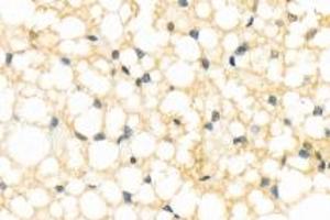 Immunohistochemistry analysis of paraffin-embedded rat brown fat using,Resistin (ABIN7075402) at dilution of 1: 800 (Resistin antibody)