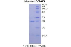 SDS-PAGE analysis of Human Vav 3 Oncogene Protein. (VAV3 Protein)