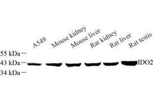Western blot analysis of IDO2 (ABIN7074281) at dilution of 1: 500