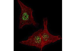 Fluorescent confocal image of HeLa cells stained with FGFR4 antibody. (FGFR4 antibody  (N-Term))