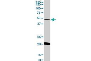 NADK monoclonal antibody (M01), clone 5F4 Western Blot analysis of NADK expression in HeLa . (NADK antibody  (AA 1-446))