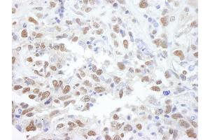 Immunohistochemistry (IHC) image for anti-Protein Phosphatase 4, Catalytic Subunit (PPP4C) (AA 1-50) antibody (ABIN7448739)
