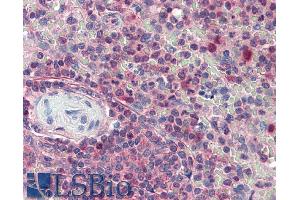 ABIN185516 (5µg/ml) staining of paraffin embedded Human Spleen. (KPNB1 antibody  (C-Term))