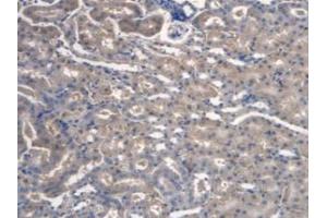 IHC-P analysis of Mouse Kidney Tissue, with DAB staining. (TMEM27 antibody  (Leu222))