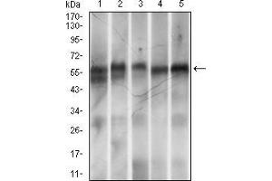 Western blot analysis using Ring1 mouse mAb against MOLT-4 (1), LNCaP (2), Hela (3), HEK-293 (4) and Jurkat (5) cell lysate. (RING1 antibody  (AA 79-263))