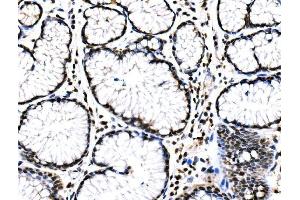 IHC analysis of RAD18 using anti-RAD18 antibody (ABIN7599364). (RAD18 antibody  (AA 1-408))