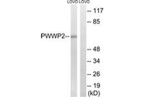 Western blot analysis of extracts from LOVO cells, using PWWP2B Antibody. (PWWP2B antibody  (AA 268-317))