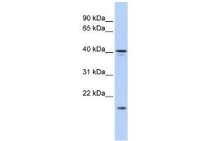 SLAIN1 antibody used at 1 ug/ml to detect target protein. (SLAIN1 antibody  (Middle Region))