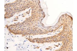 ABIN6267308 at 1/100 staining human skin tissue sections by IHC-P. (C-JUN antibody  (pTyr170))