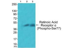 Western blot analysis of extracts from JK cells (Lane 2) and COS7 cells (Lane 3), using Retinoic Acid Receptor α (Phospho-Ser77) Antibody. (Retinoic Acid Receptor alpha antibody  (pSer77))