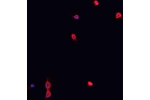 ABIN6267023 staining K-562 cells by IF/ICC. (Nibrin antibody  (pSer278))