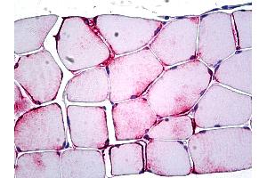 PPP1R13L antibody  (AA 75-125)