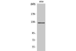 Western Blotting (WB) image for anti-PTK2 Protein tyrosine Kinase 2 (PTK2) (Thr435) antibody (ABIN3180042) (FAK antibody  (Thr435))