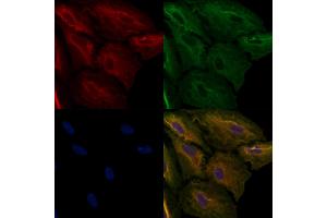 ABIN6257890 and ABIN6274946 staining  cells by IF/ICC. (CAGE1 antibody  (C-Term))