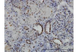 Immunohistochemistry (Formalin-fixed Paraffin-embedded Sections) (IHC (fp)) image for anti-serum/glucocorticoid Regulated Kinase 1 (SGK1) (AA 1-90) antibody (ABIN562853)