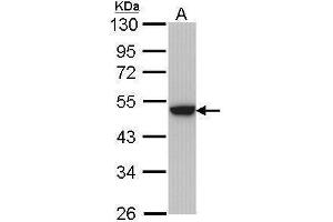 WB Image Sample (30 ug of whole cell lysate) A: Hela 10% SDS PAGE antibody diluted at 1:1000 (Keratin 31 antibody)