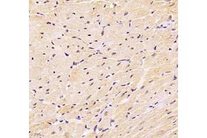 Immunohistochemistry of paraffin embedded mouse heart using DDX19B (ABIN7073694) at dilution of 1: 1000 (400x lens)