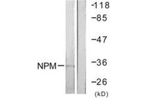 Western blot analysis of extracts from Jurkat cells, using NPM (Ab-199) Antibody. (NPM1 antibody  (AA 171-220))