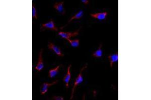Image no. 3 for anti-KIT Ligand (KITLG) (C-Term) antibody (ABIN357009)