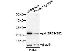 Western blot analysis of extracts of HeLa cells, using Phospho-HSPB1-S82 antibody (ABIN5969898) at 1/1000 dilution. (HSP27 antibody  (pSer82))