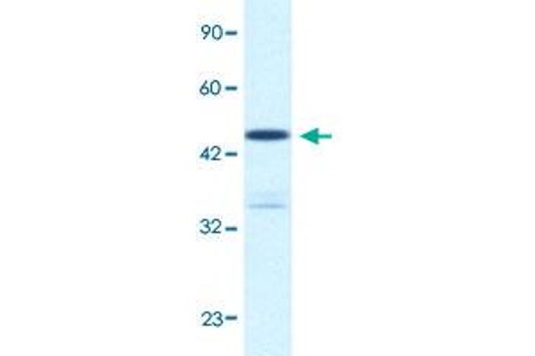 KCNAB3 antibody  (N-Term)