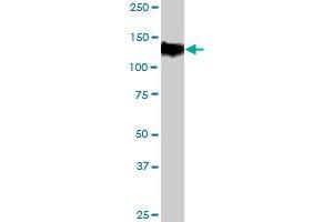 Thyroperoxidase antibody  (AA 1-933)