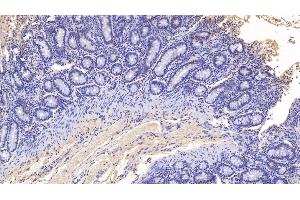 Detection of MPO in Bovine Colon Tissue using Monoclonal Antibody to Myeloperoxidase (MPO) (Myeloperoxidase antibody)