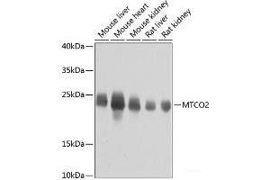 Western blot analysis of extracts of various cell lines using MTCO2 Polyclonal Antibody at dilution of 1:800. (COX2 antibody)