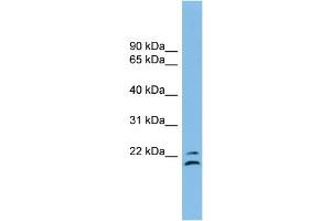 WB Suggested Anti-TSPAN1 Antibody Titration: 0. (TSPAN1 antibody  (Middle Region))