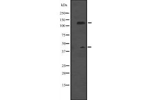 Western blot analysis of MCM9 expression in Rat brain tissue lysate ,The lane on the left is treated with the antigen-specific peptide.