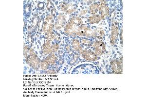 Rabbit Anti-UROD Antibody  Paraffin Embedded Tissue: Human Kidney Cellular Data: Epithelial cells of renal tubule Antibody Concentration: 4.
