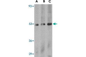 Western blot analysis of PLXDC1 in human liver tissue lysate with PLXDC1 polyclonal antibody  at (A) 0.