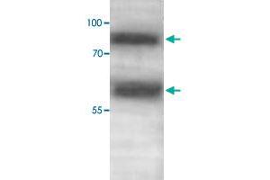 Western blot analysis of human fetal skeletal muscle lysate with ADAMTS1 polyclonal antibody  at 1 : 500 dilution. (ADAMTS1 antibody  (C-Term))