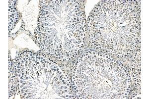 ABIN7095306 and ABIN7099363 at 1/100 staining rat testis tissue by IHC-P. (PARP14 antibody)